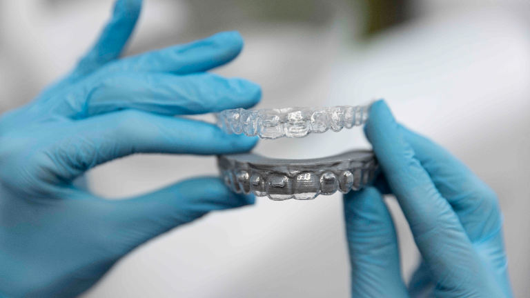 An advantageous alternative to braces: Transparent aligners
