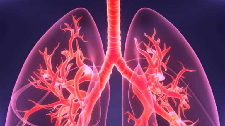 Cystic Fibrosis