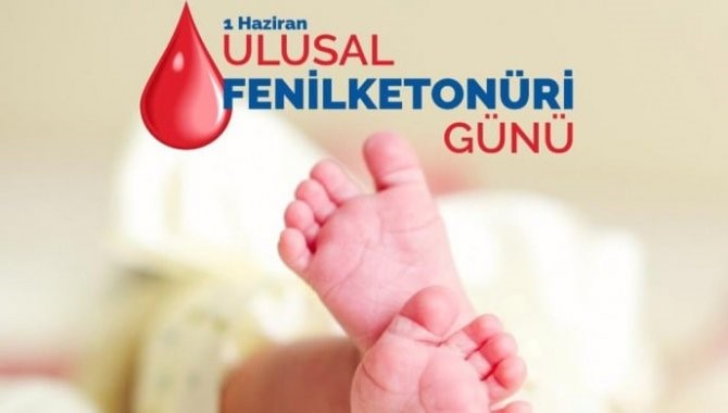 fenilketonüri