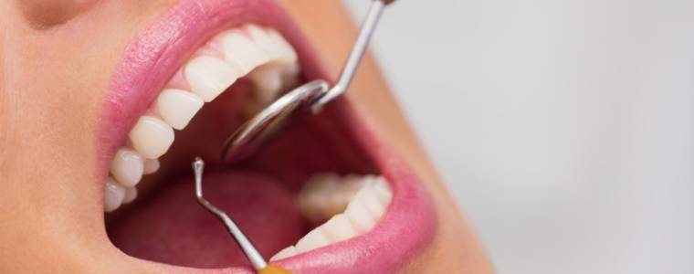 Ön Diş Estetik Dolgusu Kullanım Ömrü