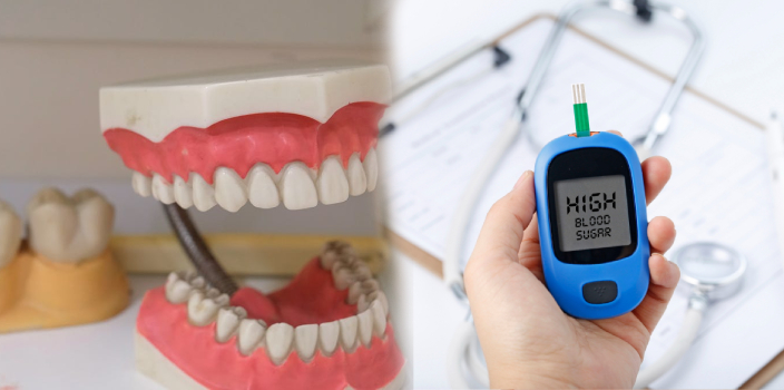 Diyabet ve Diş Sağlığı: Diş Eti Hastalığı Riski