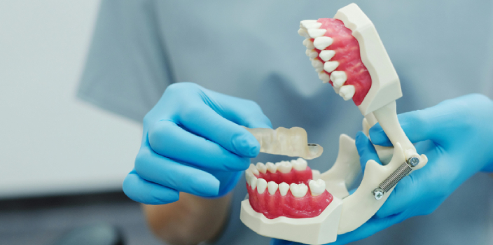 Ortodonti Tedavisi Ne Kadar Sürer? Süreyi Etkileyen Faktörler