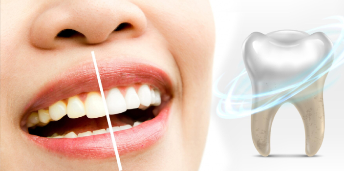 Sigara İçenlerde Diş Beyazlatma Ne Kadar Etkilidir?