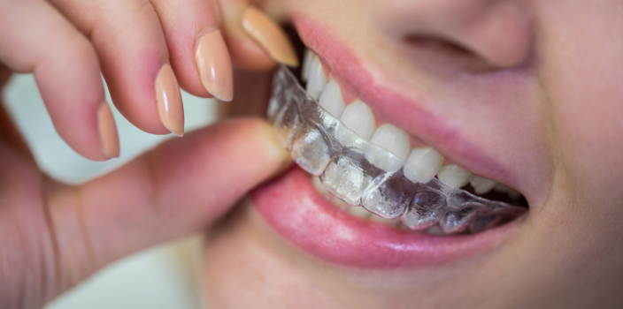 Diş Sıkma (Bruksizm) Nedir? Belirtileri ve Tedavi Yöntemleri