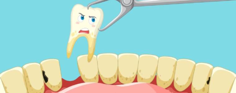 Tek Diş Eksikliği Tedavi Yöntemlerinin Avantajları
