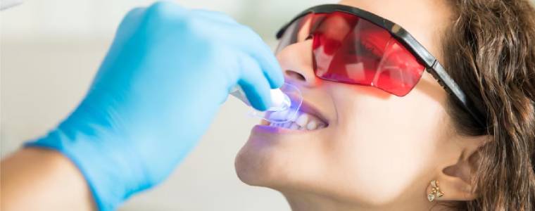 Diş Taşı ve Temizliği